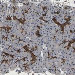 TDRKH Polyclonal Antibody