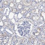 DARC Antibody in Immunohistochemistry (Paraffin) (IHC (P))
