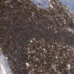 PASK Polyclonal Antibody