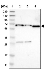 HRI Antibody in Western Blot (WB)