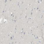 MYL3 Antibody in Immunohistochemistry (Paraffin) (IHC (P))