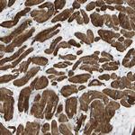 MYL3 Polyclonal Antibody