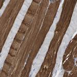 MYL3 Antibody in Immunohistochemistry (Paraffin) (IHC (P))