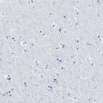 TCL1A Polyclonal Antibody