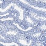 TCL1A Antibody in Immunohistochemistry (Paraffin) (IHC (P))