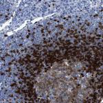 TCL1A Antibody in Immunohistochemistry (Paraffin) (IHC (P))