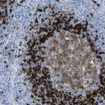 TCL1A Antibody in Immunohistochemistry (Paraffin) (IHC (P))
