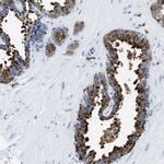 OR14K1 Polyclonal Antibody