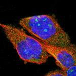 PPM1B Polyclonal Antibody