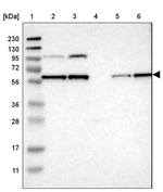 PPM1B Antibody in Western Blot (WB)