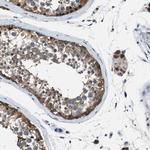 Acid Phosphatase 1 Polyclonal Antibody