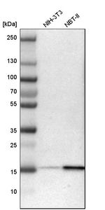 Acid Phosphatase 1 Antibody in Western Blot (WB)