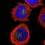 ZDHHC13 Polyclonal Antibody