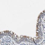 ZDHHC13 Antibody in Immunohistochemistry (Paraffin) (IHC (P))