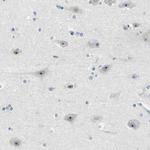 RRP1 Antibody in Immunohistochemistry (Paraffin) (IHC (P))