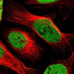 SAFB Polyclonal Antibody