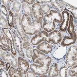 SLC25A31 Antibody in Immunohistochemistry (Paraffin) (IHC (P))