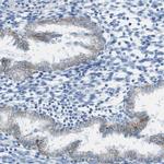CD46 Antibody in Immunohistochemistry (Paraffin) (IHC (P))