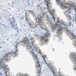 CD46 Antibody in Immunohistochemistry (Paraffin) (IHC (P))