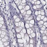 C16orf89 Antibody in Immunohistochemistry (Paraffin) (IHC (P))