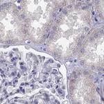 C16orf89 Antibody in Immunohistochemistry (Paraffin) (IHC (P))