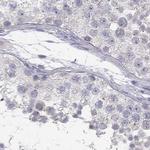 C16orf89 Antibody in Immunohistochemistry (Paraffin) (IHC (P))