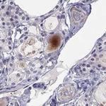 C16orf89 Antibody in Immunohistochemistry (Paraffin) (IHC (P))