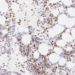 PADI4 Antibody in Immunohistochemistry (Paraffin) (IHC (P))