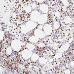 PADI4 Antibody in Immunohistochemistry (Paraffin) (IHC (P))