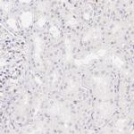 PADI4 Antibody in Immunohistochemistry (Paraffin) (IHC (P))