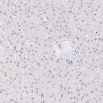 PADI4 Antibody in Immunohistochemistry (Paraffin) (IHC (P))