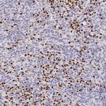 PADI4 Antibody in Immunohistochemistry (Paraffin) (IHC (P))