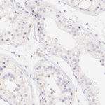 PADI4 Polyclonal Antibody