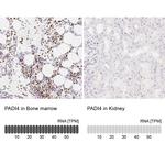PADI4 Antibody