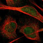 PIP5K1C Polyclonal Antibody