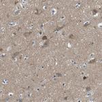 PIP5K1C Antibody in Immunohistochemistry (Paraffin) (IHC (P))