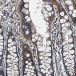 PIP5K1C Antibody in Immunohistochemistry (Paraffin) (IHC (P))