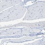 PIP5K1C Antibody in Immunohistochemistry (Paraffin) (IHC (P))