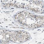 PIP5K1C Antibody in Immunohistochemistry (Paraffin) (IHC (P))