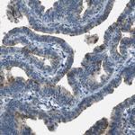 Mesothelin Antibody in Immunohistochemistry (Paraffin) (IHC (P))