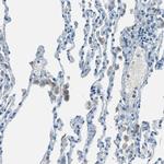 Mesothelin Antibody in Immunohistochemistry (Paraffin) (IHC (P))