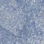 Mesothelin Antibody in Immunohistochemistry (Paraffin) (IHC (P))