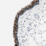 Mesothelin Polyclonal Antibody