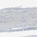 Mesothelin Antibody in Immunohistochemistry (Paraffin) (IHC (P))