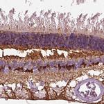 CRABP1 Polyclonal Antibody