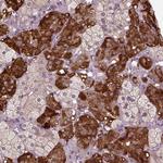 ERV3 Antibody in Immunohistochemistry (Paraffin) (IHC (P))