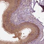 ERV3 Antibody in Immunohistochemistry (Paraffin) (IHC (P))