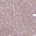 ERV3 Antibody in Immunohistochemistry (Paraffin) (IHC (P))