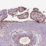 ERV3 Antibody in Immunohistochemistry (Paraffin) (IHC (P))