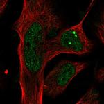 PLXDC2 Polyclonal Antibody